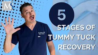 Tummy Tuck Recovery - 5 stages