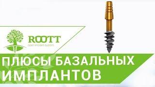 Базальные импланты. ⮚ В чем особенность базальных имплантов? Клиника ROOTT