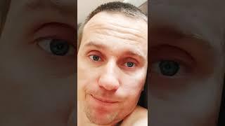 аллергия на табак