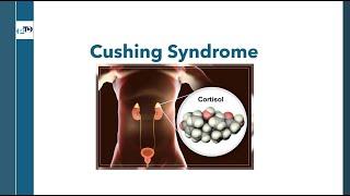 Understanding Cushing Syndrome: Essential Knowledge for OPRA Exam