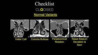 Pre-op FESS Checklist - Dr. Suresh Mukherji - Medality (MRI Online) Radiology Noon Conference