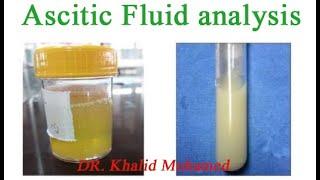 Ascitic fluid analysis.  تحليل السائل البريتوني