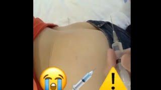 intramuscular. buttock injection