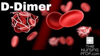 What the D Dimer test tells you.