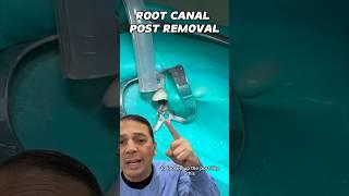 Removing a Root Canal Post | In Office to Hands On Dental Training #shorts