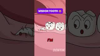 The Annoying Truth About Wisdom Teeth!
