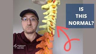 How to PROVE What a NORMAL Spine Looks Like