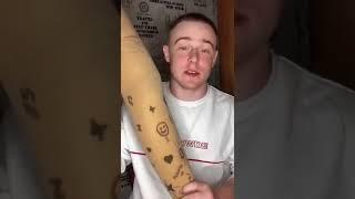 Можно ли на протезе ходить по лестницам? 