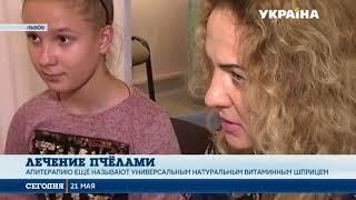 Лечение пчёлами повышает иммунитет, снижает холестерин и помогает при артрите