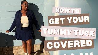 HOW TO GET YOUR TUMMY TUCK COVERED BY INSURANCE (Aetna)