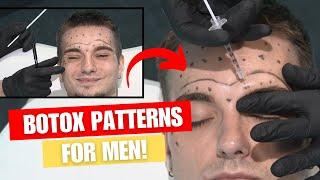 Male Botox Patterns & Injection Tutorial with 3D Anatomy!