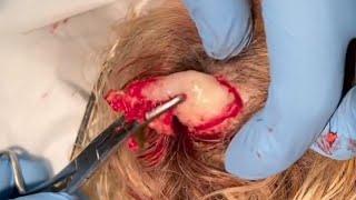 The Shrimp Removal | Dr. John Gilmore (Just the Pop)
