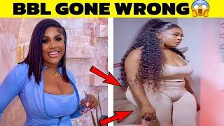 Top Nollywood Actresses Plastic Surgery Gone Wrong!