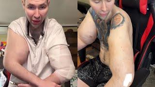 Bazooka Arm Gets Drained, Finally!