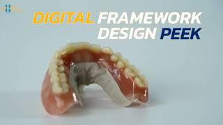 CAD/CAM Removable Denture