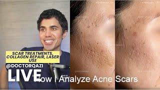 Dr. Qazi discusses: Scar Treatments, Collagen Repair, & Laser use | Unsponsored Live | 6.17.2025