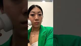 What it’s like getting masseter Botox and trap Botox at Muse Clinic in Gangnam Seoul