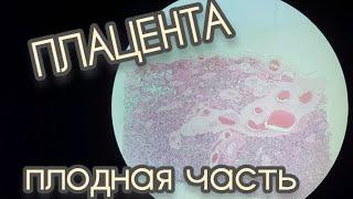 ПЛАЦЕНТА ПЛОДНАЯ ЧАСТЬ