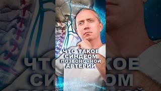 Синдром Позвоночной Артерии - Скрытый убийца! #здоровье #шишонин