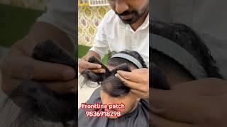 Frontline hair patch men’s #frontline hair patch in Kolkata #frontline hair wig#hairstyle human hair