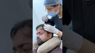 Cara Aesthetics - Hair Transplant & Skin Care Clinic