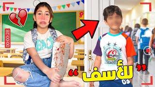 للأسف..‼️شخص مشاغب في المدرسة هجم على رانيا (تهرسات من رجليها)