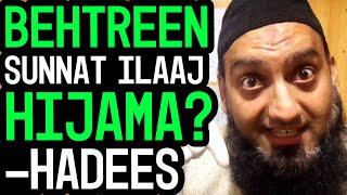 What is Hijama & its Benefits ? || How to do RIGHT Hijama ?