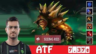 [DOTA 2] ATF the BRISTLEBACK [OFFLANE] [7.37e] [4]