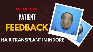 Best Hair Transplant in Indore | Patient From Indore, | FUE Method | 2024