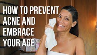 How to Prevent Acne and Age Flawlessly | Peaches Skin Care