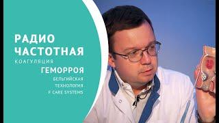 Радиочастотная коагуляция геморроя