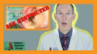 Should My Video Be Age Restricted? | Auburn Medical Group