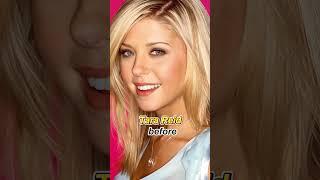 11 Celebrities WhoHave Been DisfiguredBy Plastic Surgery #actor #facts