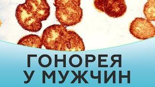 Гонорея у мужчин. Лечение гонореи