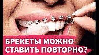 Можно ли использовать брекеты повторно?