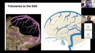 2020 04 21 BANANAZ Venous Sinuses