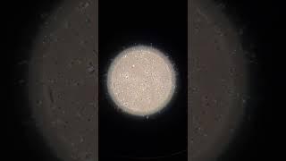 Inside the Lab: Sperm Under the Microscope! #EmbryologyInsights