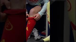 🟡 ‘Calcetines desparejados’ por el #DíaMundialSíndromeDown |  SEFUTBOL