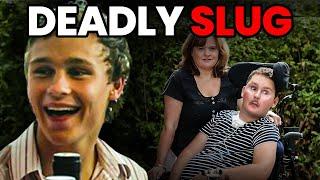 The TRAGIC Story Of Sam Ballard Who ATE a Slug & Passed Away At 28.. 