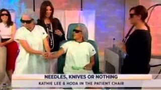 GentleMax Pro for Laser Hair Removal on The Today Show