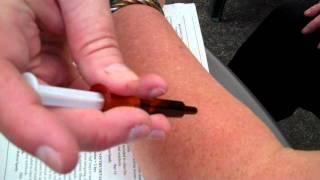 transepidermal-barrier-disruption.MP4