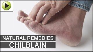 Skin Care - Chilblain - Natural Ayurvedic Home Remedies