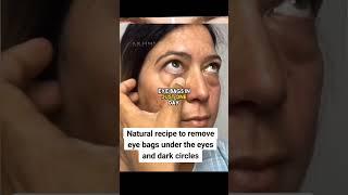  Fast ways to remove under eye bags