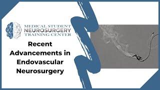 Recent Advancements in Endovascular Neurosurgery