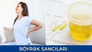 Böyrək Sancıları - Səbəbləri və Müalicəsi - Elza Binnətova ( Uroloq )