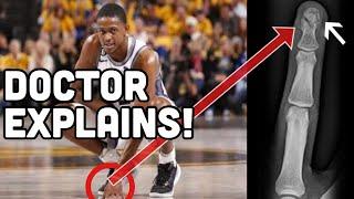 De'Aaron Fox' INSIDIOUS Finger Fracture | How Long is he OUT? | DOCTOR Explains