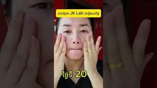 មន្ទីរពិសោធន៍ JK ព្យាបាលស្នាមអុចខ្មៅ និងអាចម៍រុយ #JK lab japan