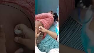 intramuscular Injection video