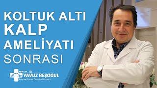 Koltuk Altı Kalp Ameliyatı Sonrası | Kalp ve Damar Cerrahisi - Prof. Dr. Yavuz Beşoğul