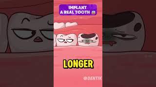 DENTISTS Are Hiding This Crazy Tooth Reimplantation Secret!   | Funny Dental Animation!